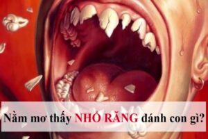 Mơ thấy răng đánh con gì? Bật mí số đề chi tiết tại Gi8